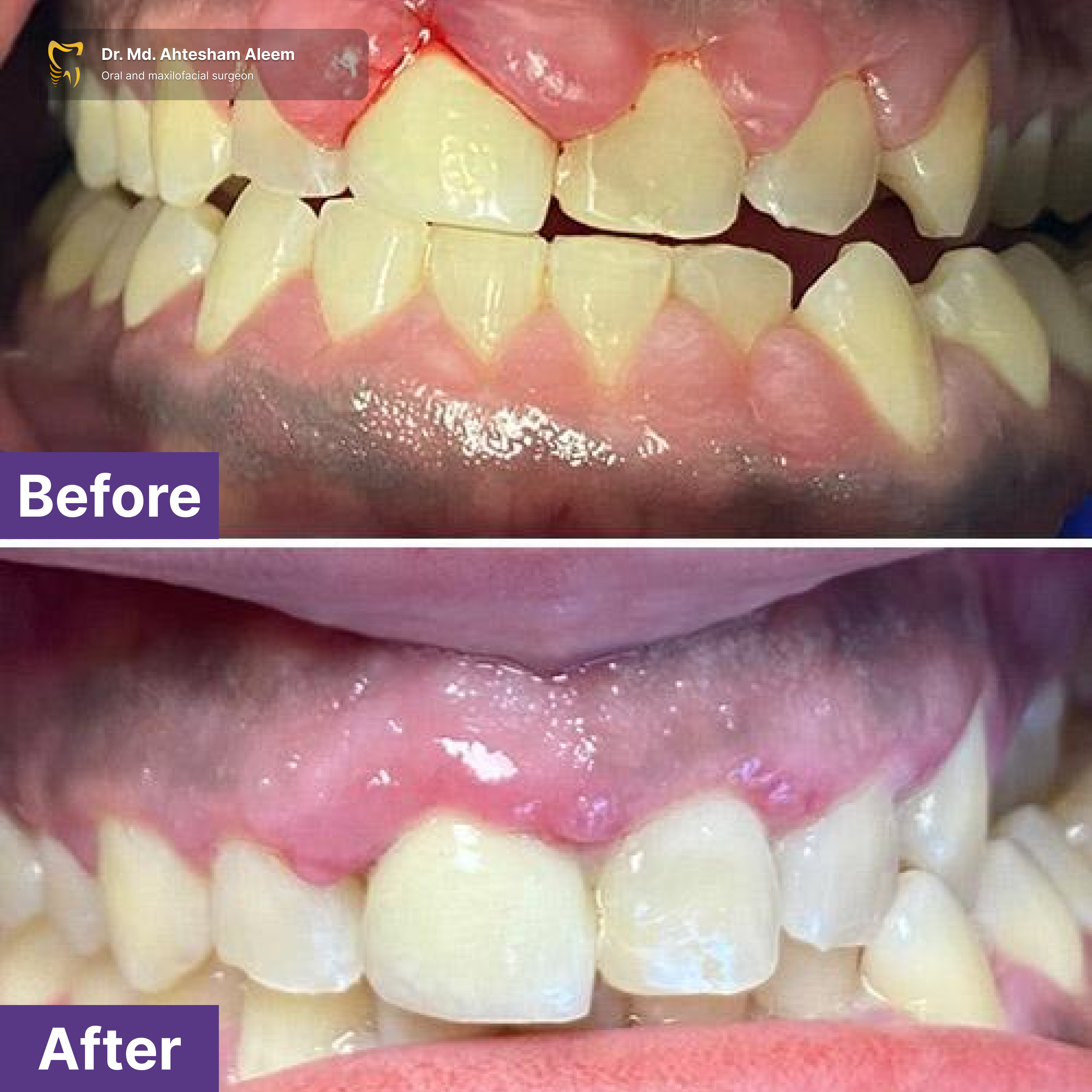 Advanced Laser Dentistry Gallery 3